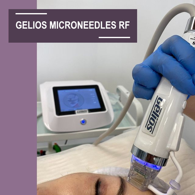 GELIOS MICRONEEDLES RF